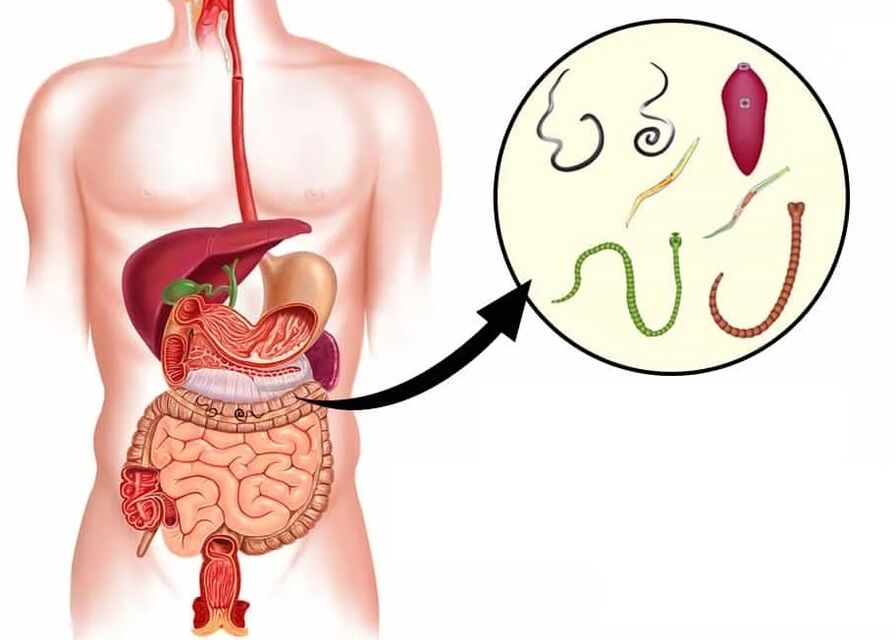 Vermixin aiuta con la maggior parte dei tipi di elminti