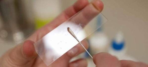 Raschiatura per le uova di vermi